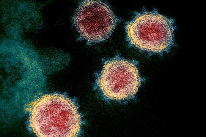 Coronavirus_SARS-CoV-2b Coronavirus