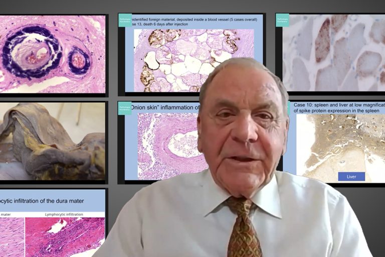 patho Pathologie-Konferenz: Impfinduzierte Spike-Produktion in Gehirn u.a. Organen nun erwiesen